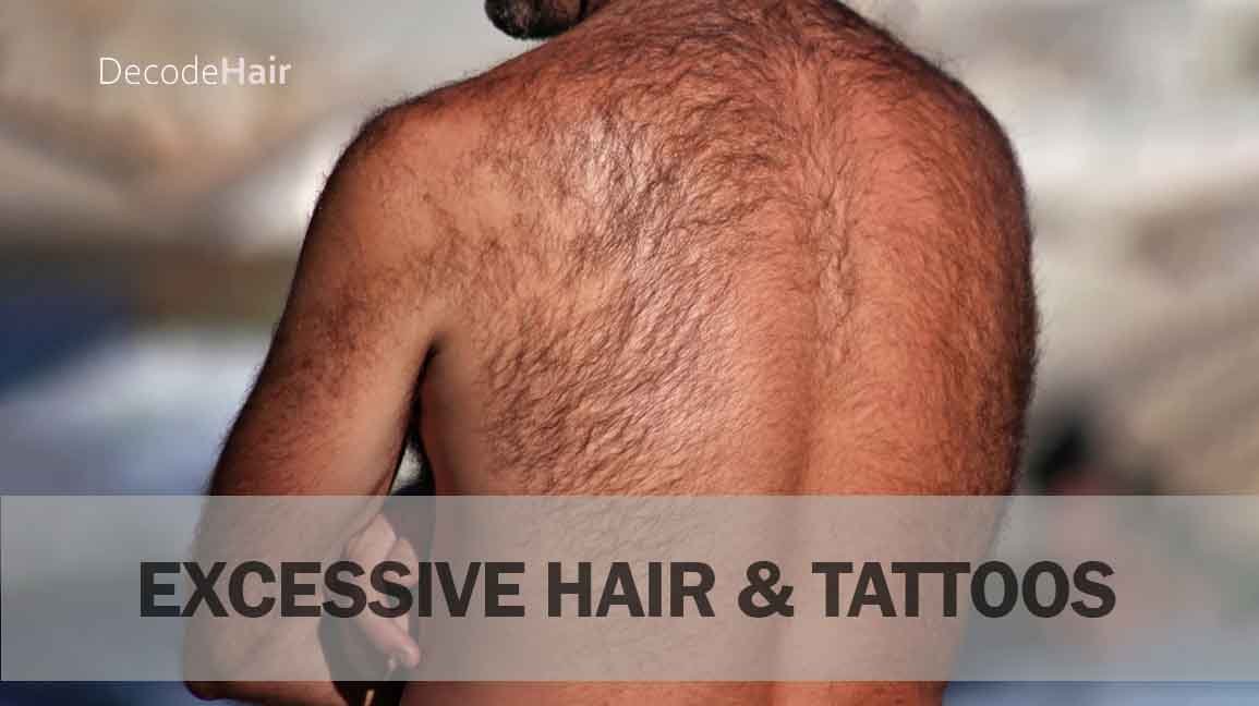 Will Excessive Body Hair Affect Tattoos