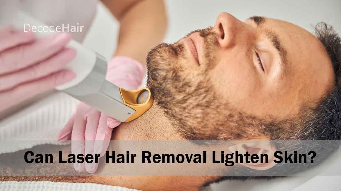 Can Laser Hair Removal Lighten Skin