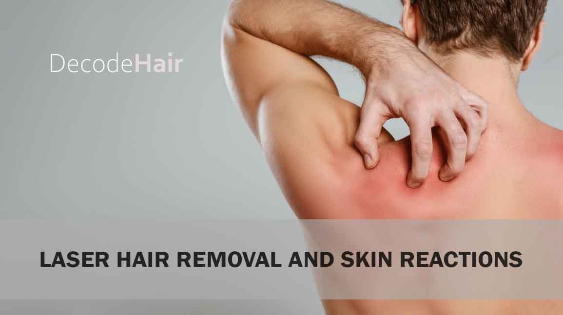 Can Laser Hair Removal Cause Skin Reactions?
