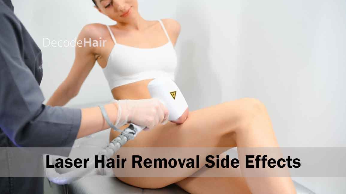 Laser Hair Removal Side Effects